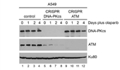 ATM-deficient lung, prostate and pancreatic cancer cells are acutely sensitive to the combination of olaparib and the ATR inhibitor AZD6738