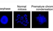 USP11 suppresses CHK1 activation by deubiquitinating CLASPIN