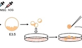 Mitochondrial DNA mutation affects the pluripotency of embryonic stem cells with metabolism modulation