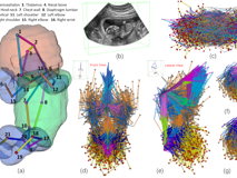 医学部倪东教授团队在《Medical Image Analysis》上发表文章