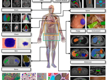 医学部倪东教授团队在《Medical Image Analysis》上发表文章