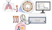 Success of electrochemical immunosensors for the determination of hepatitis B surface antigen, an important clinical marker in the diagnosis of hepatitis B